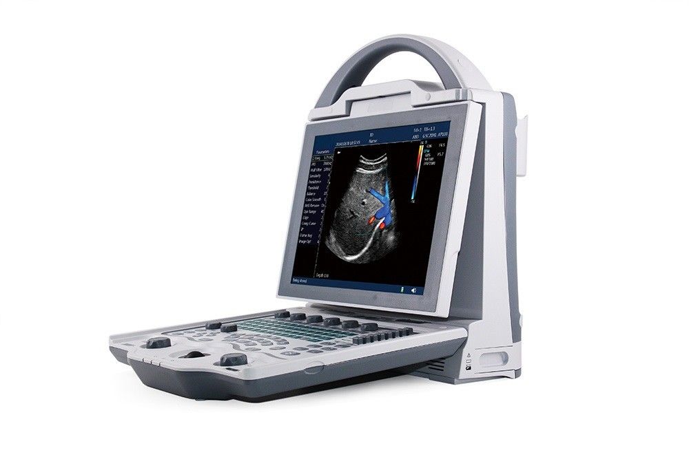 Gebelik için 16GB Giriş Seviyesi 2D Dizüstü Renkli Doppler Ultrason Sistemi