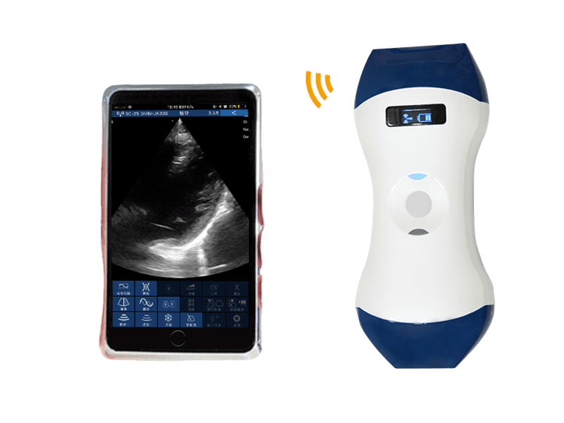 FDA CE ISO13485 Avuç İçi Boyutunda Kablosuz El Tipi Ultrason Probu, POCUS için Faz Dizili ve Doğrusal Çift Kafalı